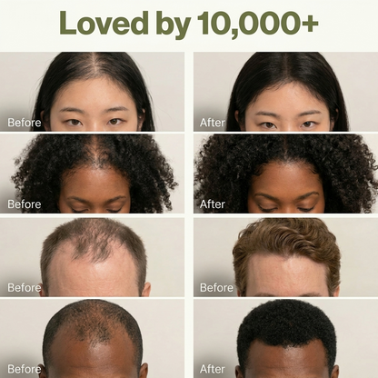 Hanna Korean Scalp Revival Bar — 90-Day Scalp System